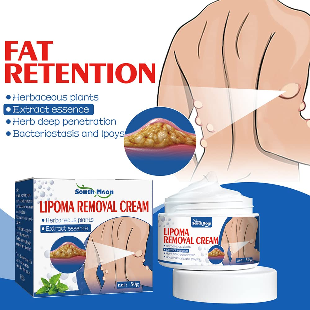 Herbal Lipoma Removal Cream (50gm) 🔥FLASH SALE🔥