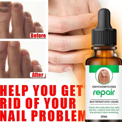 All in One Nail Growth & Repair Serum 🔥 80% Off Sale🔥