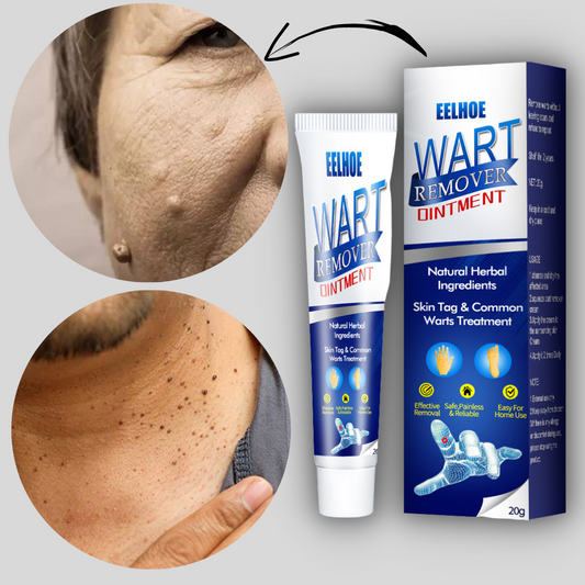 Warts Remover Ointment Cream- 🔥BUY 1 GET 1 FREE🔥FLASH SALE