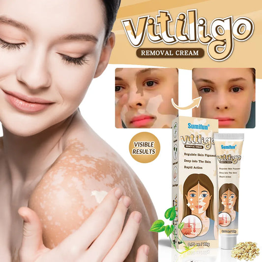 Sumifun White Spot Vitiligo Treament Cream - BUY 1 GET 1 FREE